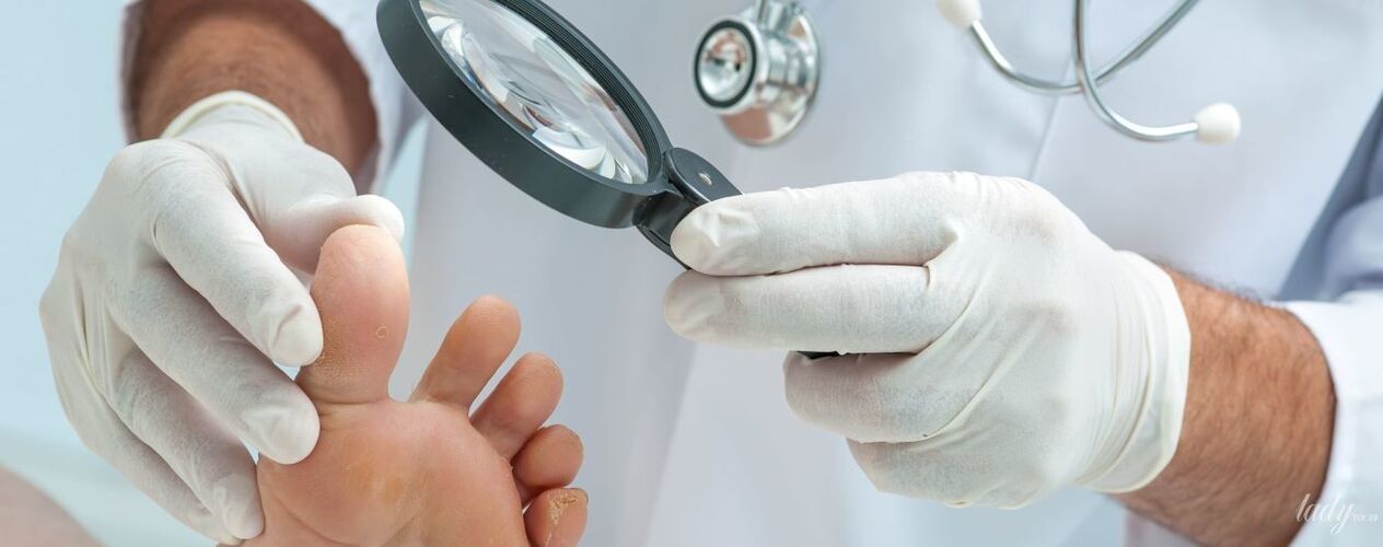 Le médecin examine le champignon au pied du pied