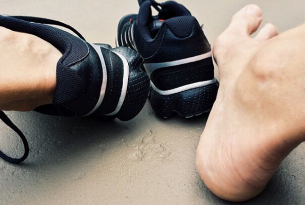 Les causes de l'apparition de la legcose des jambes