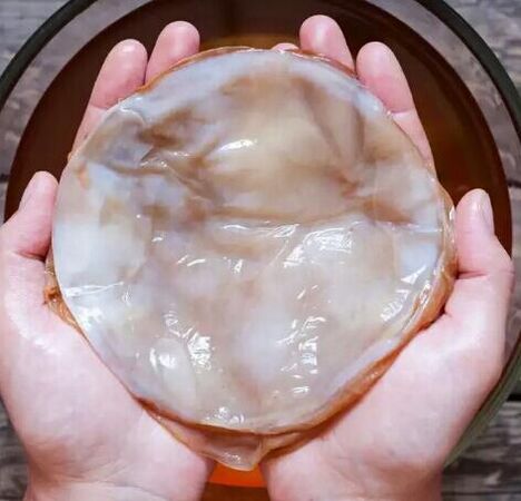 champignon des ongles kombucha